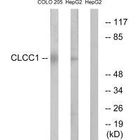Western blot analysis of extracts from COLO cells and HepG2 cells, using CLCC1 antibody.