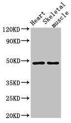 Western Blot Positive WB detected in: Mouse heart tissue, Mouse skeletal muscle tissue All lanes: CD36 antibody at 2ug/ml Secondary Goat polyclonal to rabbit IgG at 1/50000 dilution Predicted band size: 54, 33, 49, 47 kDa Observed band size: 49 kDa