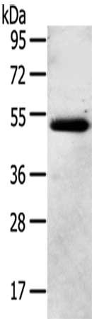 Gel: 8%SDS-PAGE,Lysate: 40 ug,,Primary antibody: CSB-PA094813(NR2F2 Antibody) at dilution 1/200 dilution,Secondary antibody: Goat anti rabbit IgG at 1/8000 dilution,Exposure time: 1 minute