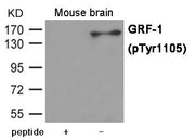 Western blot analysis of extracts from Mouse brain tissue using GRF-1 (Phospho-Tyr1105) Antibody.The lane on the left is treated with the antigen-specific peptide.