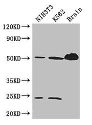 Western Blot Positive WB detected in: NIH/3T3 whole cell lysate, K562 whole cell lysate, Mouse brain tissue All lanes: TUBA4A antibody at 3ug/ml Secondary Goat polyclonal to rabbit IgG at 1/50000 dilution Predicted band size: 50, 49 kDa Observed b...