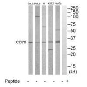 Western blot analysis of extracts from HuvEC, K562, HepG2, Jurkat, HeLa and COLO205 cells, using CD70 antibody.