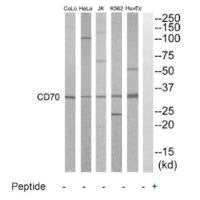 Western blot analysis of extracts from HuvEC, K562, HepG2, Jurkat, HeLa and COLO205 cells, using CD70 antibody.