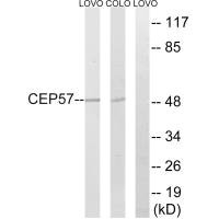 Western blot analysis of extracts from LOVO cells and COLO cells, using MRPS7 antibody.
