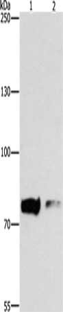 Gel: 6%SDS-PAGE, Lysate: 40 ug, Lane 1-2: Human fetal liver tissue, Human brain malignant glioma tissue, Primary antibody: CSB-PA095590(PRKCB Antibody) at dilution 1/200, Secondary antibody: Goat anti rabbit IgG at 1/8000 dilution, Exposure time:...