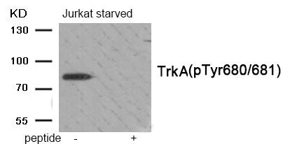 Western blot analysis of extracts from Jurkat cells treated with starved using Phospho-Trk A (Tyr680/Tyr681) antibody.The lane on the right is treated with the antigen-specific peptide.