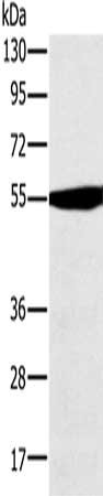 Gel: 8%SDS-PAGE, Lysate: 40 ug, Lane: Hela cells, Primary antibody: CSB-PA095719(OXCT1 Antibody) at dilution 1/300, Secondary antibody: Goat anti rabbit IgG at 1/8000 dilution, Exposure time: 10 seconds