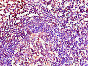 Immunohistochemistry of paraffin-embedded human tonsil tissue using CSB-PA09589A0Rb at dilution of 1:100
