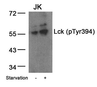 Western blot analysis of extracts from JK cells untreated or treated with starvation using Lck(Phospho-Tyr394) Antibody.