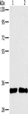 Gel: 8%SDS-PAGE, Lysate: 40 ug, Lane 1-2: A431 cells, 231 cells, Primary antibody: CSB-PA097268(ARTN Antibody) at dilution 1/350, Secondary antibody: Goat anti rabbit IgG at 1/8000 dilution, Exposure time: 2 minutes