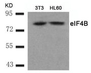 Western blot analysis of extracts from 3T3 and HL60 cells using eIF4B(Ab-422) Antibody.