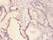 Immunohistochemistry of paraffin-embedded human prostate tissue using CSB-PA09759A0Rb at dilution of 1:100
