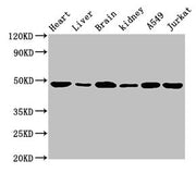 Western Blot Positive WB detected in: Mouse heart tissue, Mouse liver tissue, Mouse brain tissue, Mouse kidney tissue, A549 whole cell lysate, Jurkat whole cell lysate All lanes: ENO2 antibody at 1.5µg/ml Secondary Goat polyclonal to rabbit IgG at...