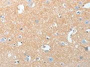 The image on the left is immunohistochemistry of paraffin-embedded Human brain tissue using CSB-PA097902(AKAP7 Antibody) at dilution 1/15, on the right is treated with fusion protein. (Original magnification: ×200)