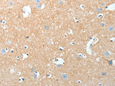 The image on the left is immunohistochemistry of paraffin-embedded Human brain tissue using CSB-PA097902(AKAP7 Antibody) at dilution 1/15, on the right is treated with fusion protein. (Original magnification: ×200)