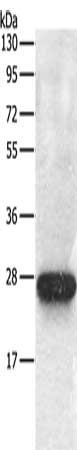 Gel: 10%SDS-PAGE, Lysate: 30 ug, Lane: Mouse brain tissue, Primary antibody: CSB-PA097939(RAB5C Antibody) at dilution 1/100, Secondary antibody: Goat anti rabbit IgG at 1/8000 dilution, Exposure time: 1 minute