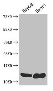 Western Blot Positive WB detected in: HepG2 whole cell lysate, Mouse heart tissue All lanes: WFDC2 antibody at 4µg/ml Secondary Goat polyclonal to rabbit IgG at 1/50000 dilution Predicted band size: 13, 9, 12 kDa Observed band size: 13 kDa