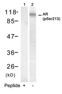 Western blot analysis of extracts from DU145 cells using Androgen Receptor(Phospho-Ser213) Antibody(Lane 2) and the same antibody preincubated with blocking peptide(Lane1).