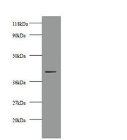 Western blot All lanes: Creatine kinase M-type antibody at 2µg/ml + 293T whole cell lysate Secondary Goat polyclonal to rabbit IgG at 1/10000 dilution Predicted band size: 44 kDa Observed band size: 44 kDa