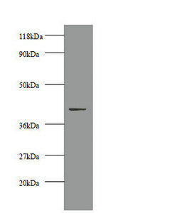 Western blot All lanes: Creatine kinase M-type antibody at 2µg/ml + 293T whole cell lysate Secondary Goat polyclonal to rabbit IgG at 1/10000 dilution Predicted band size: 44 kDa Observed band size: 44 kDa