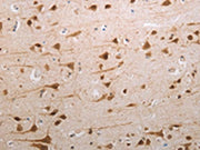 The image on the left is immunohistochemistry of paraffin-embedded Human brain tissue using CSB-PA098783(MDC1 Antibody) at dilution 1/80, on the right is treated with synthetic peptide. (Original magnification: ×200)