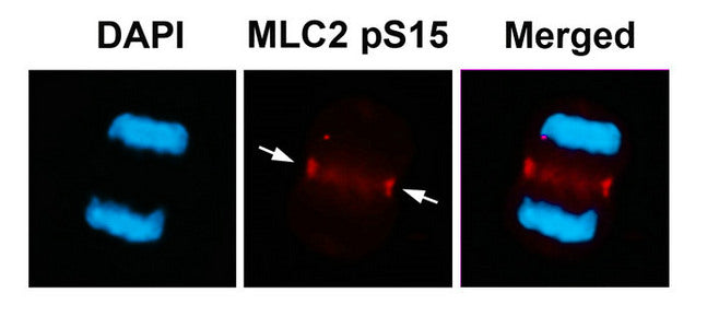 Immunofluorescence staining of methanol-fixed U87 cells using MLC2 (Phospho-Ser15) Antibody.
