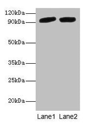 Western blot All lanes: POSTN antibody at 2µg/ml Lane 1: Mouse liver tissue Lane 2: Hela whole cell lysate Secondary Goat polyclonal to rabbit IgG at 1/10000 dilution Predicted band size: 94, 88, 84, 91, 81 kDa Observed band size: 94 kDa