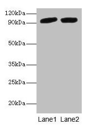 Western blot All lanes: POSTN antibody at 2µg/ml Lane 1: Mouse liver tissue Lane 2: Hela whole cell lysate Secondary Goat polyclonal to rabbit IgG at 1/10000 dilution Predicted band size: 94, 88, 84, 91, 81 kDa Observed band size: 94 kDa