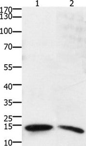 Gel: 15%+12%SDS-PAGE Lysates (from left to right): Human small intestine stromal cancer tissue Amount of lysate: 40ug per lane Primary antibody: 1/800 dilution Secondary antibody dilution: 1/8000 Exposure time: 10 seconds