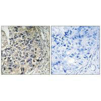 Immunohistochemistry analysis of paraffin-embedded human prostate carcinoma tissue using CMC1 antibody.
