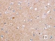 The image on the left is immunohistochemistry of paraffin-embedded Human brain tissue using CSB-PA099386(CDC7 Antibody) at dilution 1/50, on the right is treated with synthetic peptide. (Original magnification: ×200)