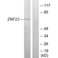 Western blot analysis of extracts from LOVO cells, using ZNF23 antibody.
