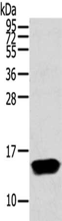 Gel: 12%SDS-PAGE,Lysate: 40 ug,,Primary antibody: CSB-PA099869(FABP1 Antibody) at dilution 1/250 dilution,Secondary antibody: Goat anti rabbit IgG at 1/8000 dilution,Exposure time: 40 seconds
