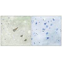 Immunohistochemistry analysis of paraffin-embedded human brain tissue, using DGKK antibody.