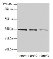 Western blot All lanes: GDF15 antibody at 4µg/ml Lane 1: HepG2 whole cell lysate Lane 2: Human placenta tissue Lane 3: A549 whole cell lysate Secondary Goat polyclonal to rabbit IgG at 1/10000 dilution Predicted band size: 35 kDa Observed band siz...