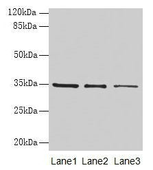 Western blot All lanes: GDF15 antibody at 4µg/ml Lane 1: HepG2 whole cell lysate Lane 2: Human placenta tissue Lane 3: A549 whole cell lysate Secondary Goat polyclonal to rabbit IgG at 1/10000 dilution Predicted band size: 35 kDa Observed band siz...