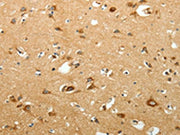 The image on the left is immunohistochemistry of paraffin-embedded Human brain tissue using CSB-PA100396(SIRT3 Antibody) at dilution 1/15, on the right is treated with fusion protein. (Original magnification: ×200)