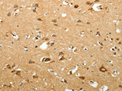The image on the left is immunohistochemistry of paraffin-embedded Human brain tissue using CSB-PA100396(SIRT3 Antibody) at dilution 1/15, on the right is treated with fusion protein. (Original magnification: ×200)