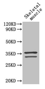 Western Blot Positive WB detected in: Mouse skeletal muscle tissue All lanes: TNNT2 antibody at 4µg/ml Secondary Goat polyclonal to rabbit IgG at 1/50000 dilution Predicted band size: 36, 35, 32, 31 kDa Observed band size: 36, 32 kDa