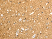 The image on the left is immunohistochemistry of paraffin-embedded Human brain tissue using CSB-PA100516(ATP1A1 Antibody) at dilution 1/15, on the right is treated with synthetic peptide. (Original magnification: ×200)