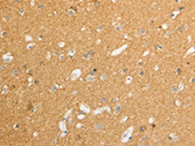 The image on the left is immunohistochemistry of paraffin-embedded Human brain tissue using CSB-PA100516(ATP1A1 Antibody) at dilution 1/15, on the right is treated with synthetic peptide. (Original magnification: ×200)