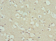 Immunohistochemistry of paraffin-embedded human brain tissue using CSB-PA10065A0Rb at dilution of 1:100