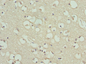 Immunohistochemistry of paraffin-embedded human brain tissue using CSB-PA10065A0Rb at dilution of 1:100