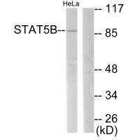 Western blot analysis of extracts from RAW264.7 cells, treated with EGF (200ng/ml 30min), using STAT5B (Ab-731) antibody.