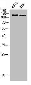 Western blot analysis of A549 3T3 using Tensin-2 antibody. Antibody was diluted at 1:500. Secondary antibody was diluted at 1:20000