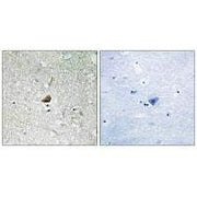 Immunohistochemistry analysis of paraffin-embedded human brain tissue using IRAK1 antibody.