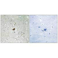 Immunohistochemistry analysis of paraffin-embedded human brain tissue using IRAK1 antibody.