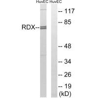 Western blot analysis of extracts from HuvEc cells, using RDX antibody.