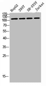 Western blot analysis of SW480 MCF7 lysate, antibody was diluted at 500. Secondary antibody was diluted at 1:20000