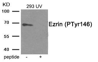 Western blot analysis of extracts from 293 cells treated with UV using Phospho-Ezrin (Tyr146) antibody.The lane on the right is treated with the antigen-specific peptide.